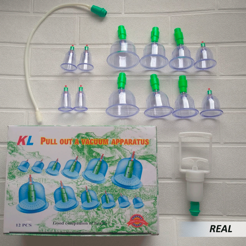Kit de ventosas chinas (12 bombas) - Imagen 2