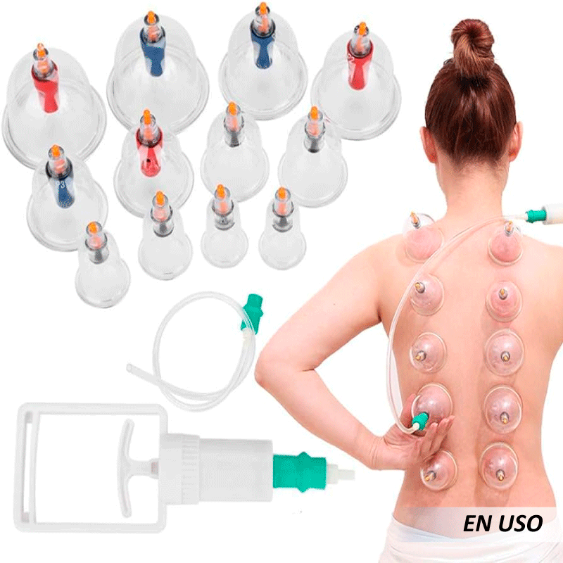 Kit de ventosas chinas (12 bombas) - Imagen 5