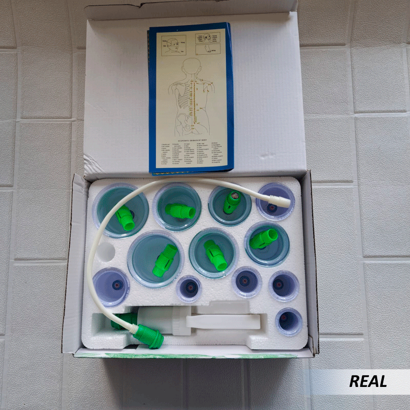 Kit de ventosas chinas (12 bombas) - Imagen 3